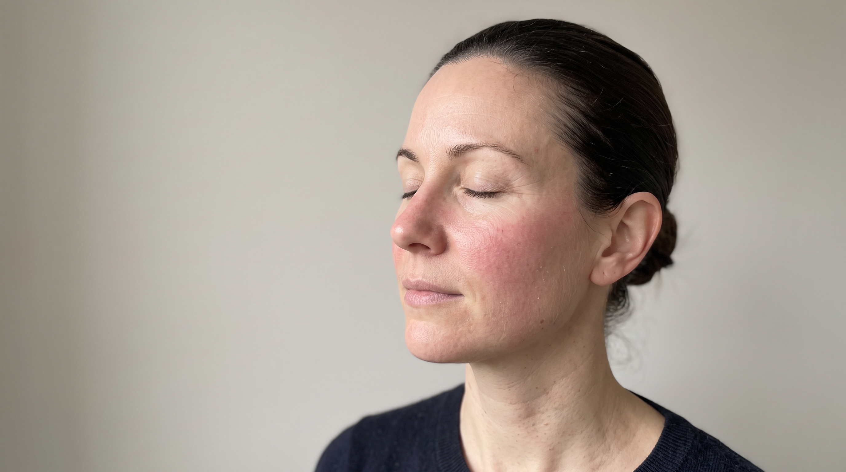 Best Serum for Microneedling: What to Apply When the Barrier Is Open