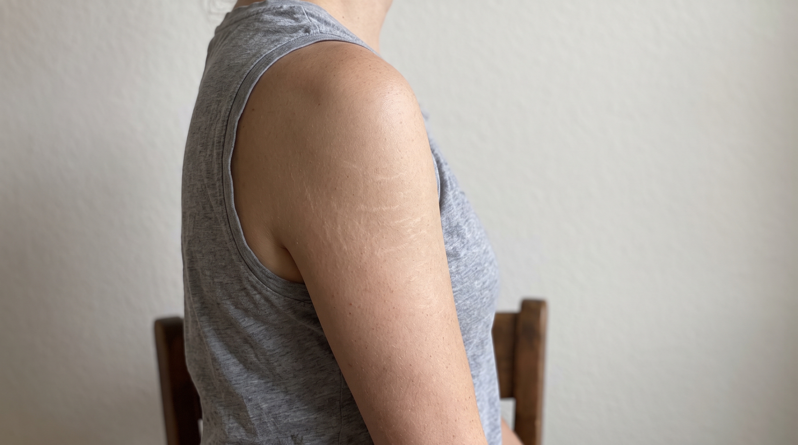 Best Stretch Mark Cream: What the Clinical Evidence Actually Supports
