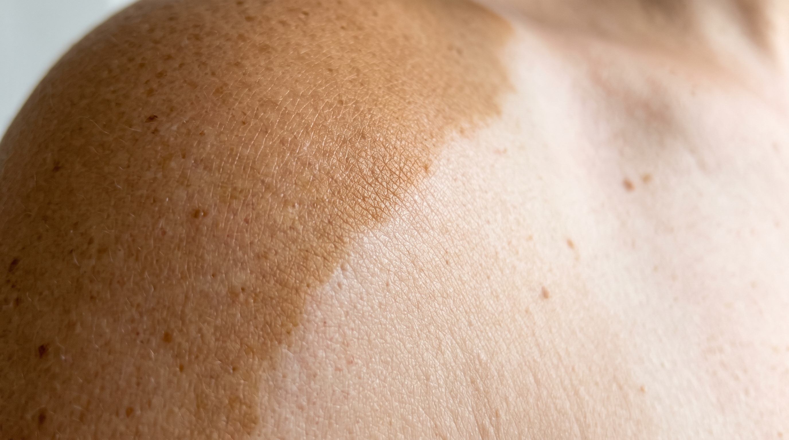 How to Remove Sun Tan From Your Face: Why It Fades on Its Own Schedule