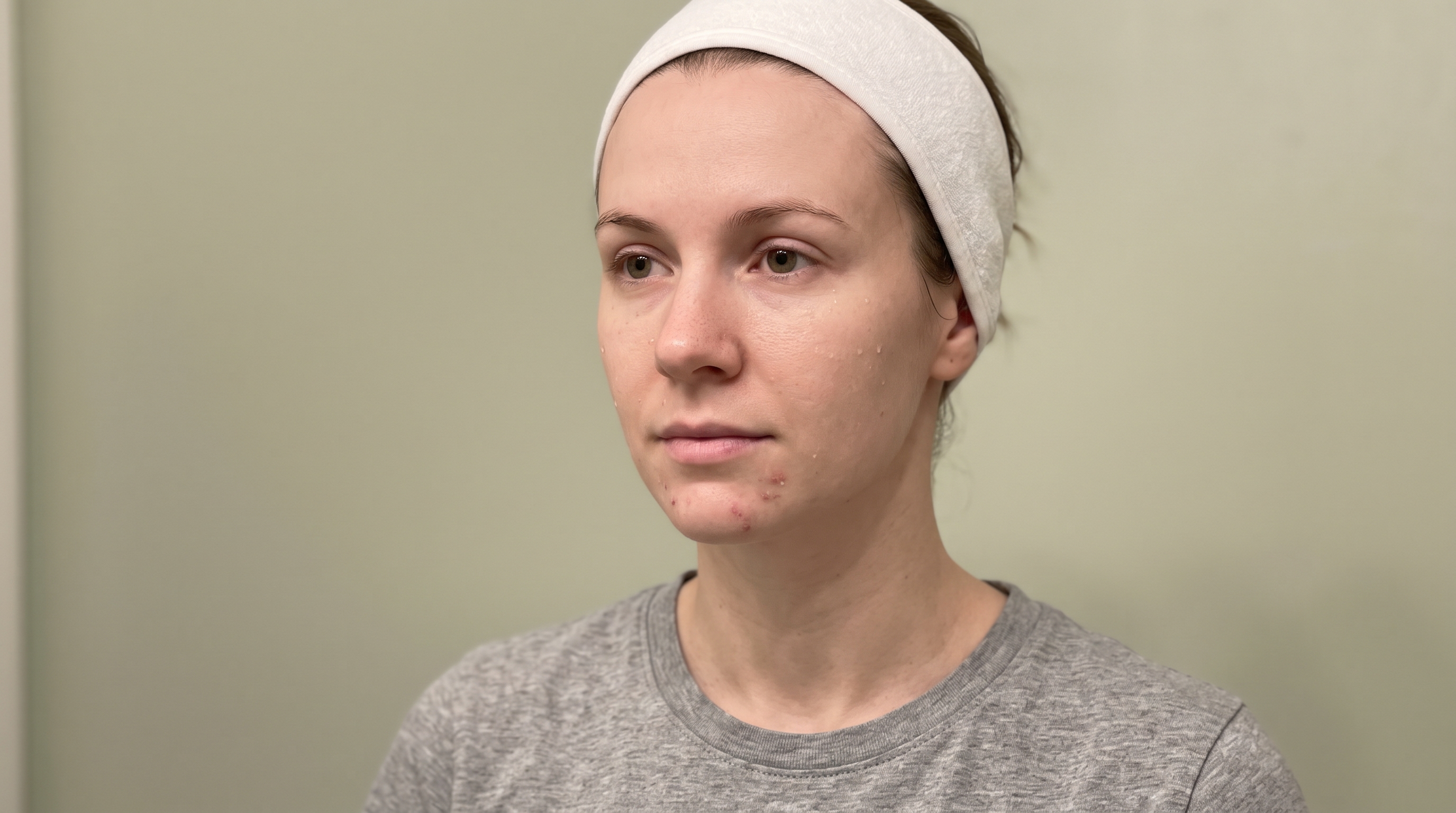 Retinol and Salicylic Acid: Can You Use Them Together, and How?