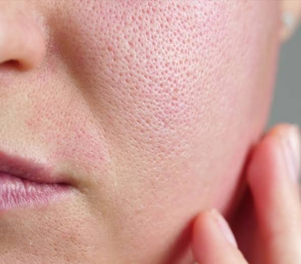 Can Retinol Shrink Pores? The Science Behind Pore Size