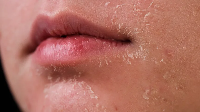 The Retinol Purge: Why Your Skin Gets Worse Before It Gets Better